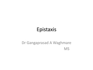 Dr Gangaprasad A Waghmare
MS
Epistaxis
 