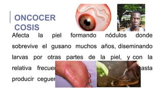 ONCOCER
COSIS
Afecta la piel formando nódulos donde
sobrevive el gusano muchos años, diseminando
larvas por otras partes de la piel, y con la
relativa frecuencia alcanzando los ojos hasta
producir ceguera
 