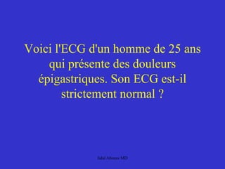 Voici l'ECG d'un homme de 25 ans
qui présente des douleurs
épigastriques. Son ECG est-il
strictement normal ?
Jalal Abouss MD
 