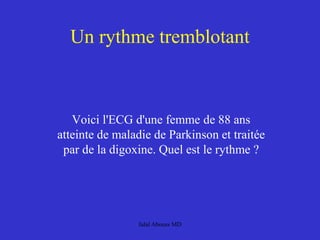 Un rythme tremblotant
Voici l'ECG d'une femme de 88 ans
atteinte de maladie de Parkinson et traitée
par de la digoxine. Quel est le rythme ?
Jalal Abouss MD
 