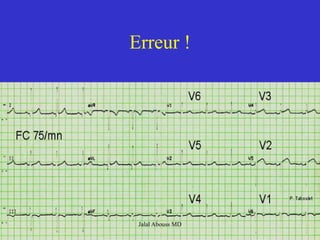 Erreur !
Jalal Abouss MD
 