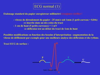 ECG normal (1)
Etalonage standard du papier enregistreur millimétré à toujours vérifier !
- vitesse de déroulement du papier : 25 mm/s soit 1mm (1 petit carreau = 0,04s)
⇒ inscrite dans un des coins du tracé
- 1 cm de haut (5 petits carreaux) = 1 mV
⇒ déflexion test au début du tracé de 1cm de haut
Possibles modifications en fonction des besoins d’interprétation : augmentation de la
vitesse de défilement par exemple pour une meilleure analyse des déflexions et du rythme.
Tracé ECG de surface :
P
Q
R
S
T
U
Jalal Abouss MD
 