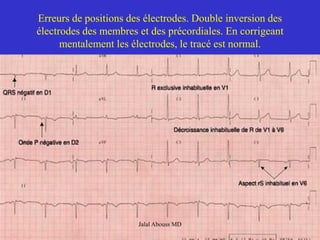 18 Heart EKG.pdf