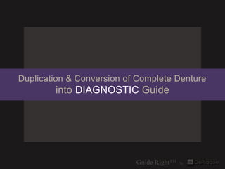 Duplication & Conversion of Complete Denture
        into DIAGNOSTIC Guide
 