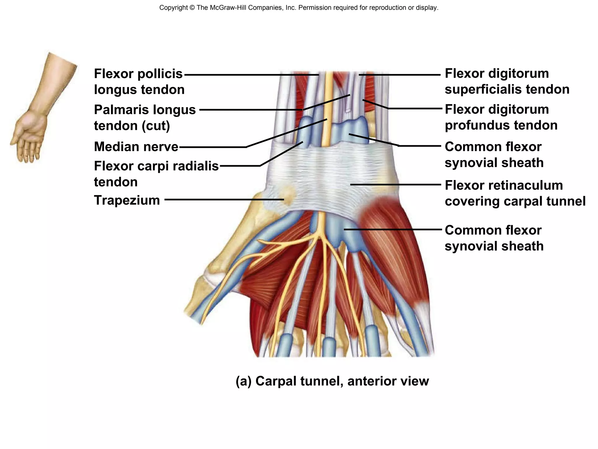 Copyright © The McGraw-Hill Companies, Inc. Permission required for reproduction or display. Palmaris longus  tendon (cut) Common flexor  synovial sheath (a) Carpal tunnel, anterior view Flexor retinaculum  covering carpal tunnel Flexor pollicis  longus tendon Flexor carpi radialis  tendon Trapezium Median nerve Flexor digitorum  profundus tendon Flexor digitorum  superficialis tendon Common flexor  synovial sheath 