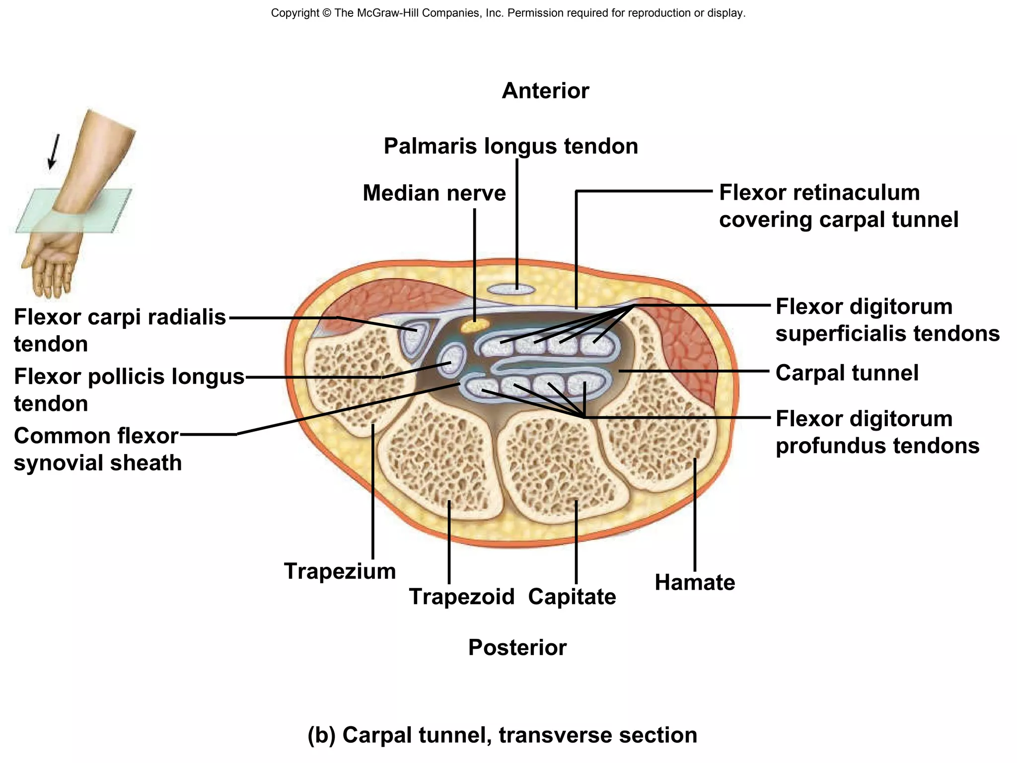 Copyright © The McGraw-Hill Companies, Inc. Permission required for reproduction or display. (b) Carpal tunnel, transverse section Carpal tunnel Median nerve Palmaris longus tendon Anterior Common flexor synovial sheath Flexor carpi radialis  tendon Flexor pollicis longus  tendon Flexor digitorum profundus tendons Flexor retinaculum covering carpal tunnel Hamate Capitate Trapezoid Trapezium Posterior Flexor digitorum superficialis tendons 