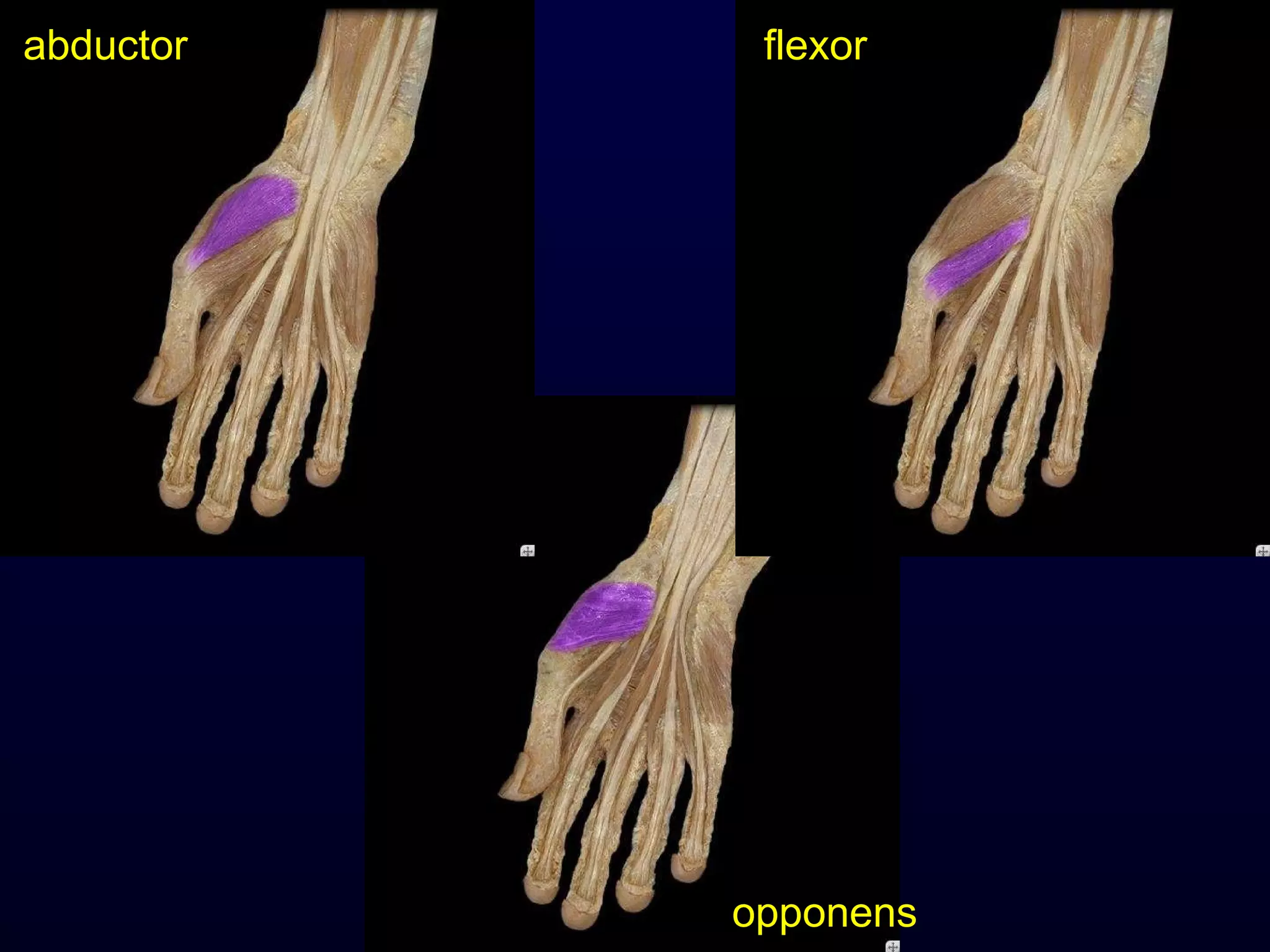 abductor flexor opponens 
