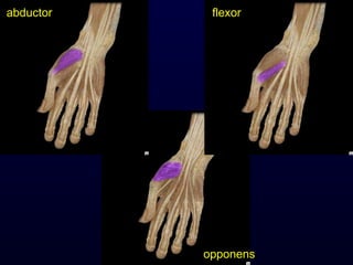 abductor flexor opponens 