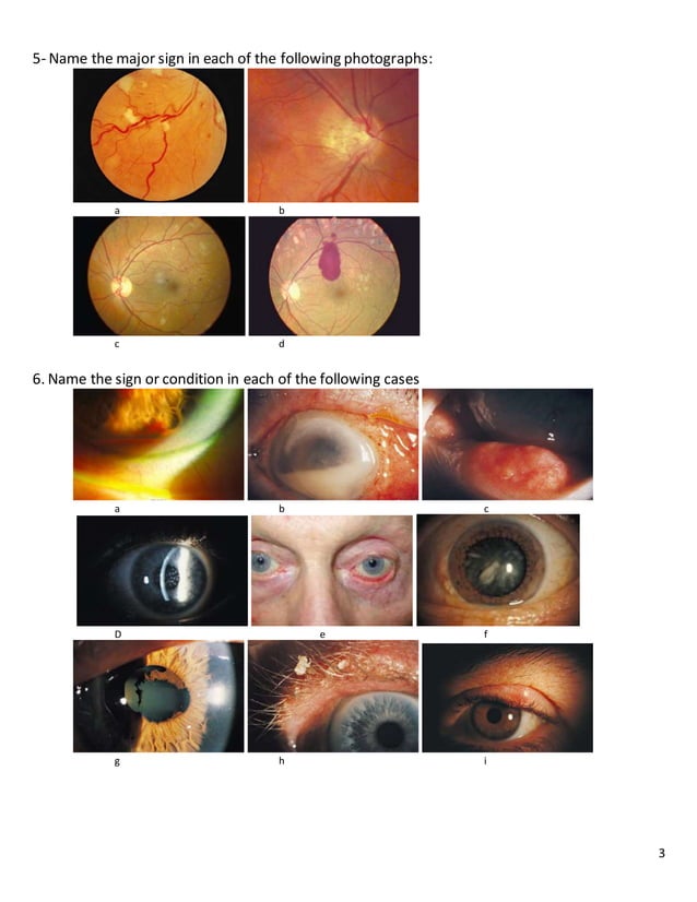 18 ophthalmology match diagnosis and signs