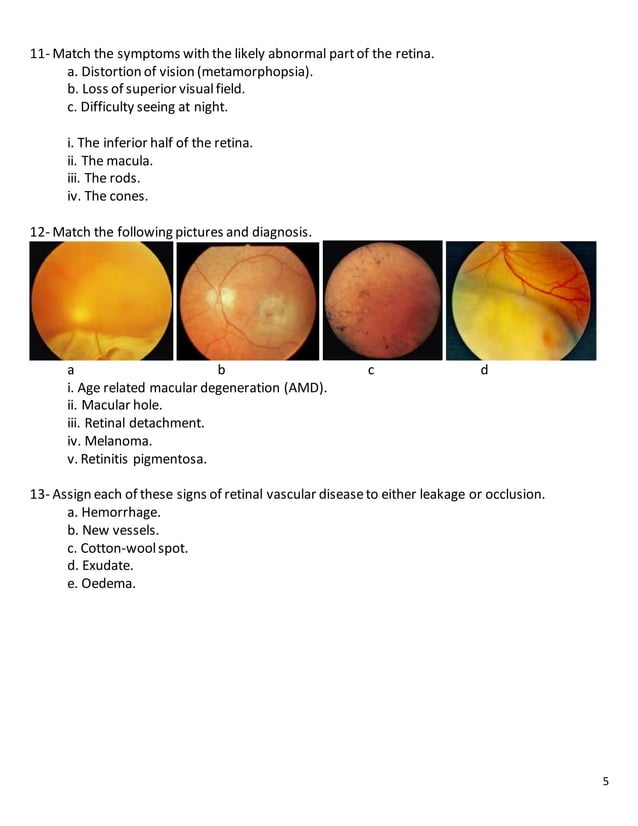 18 ophthalmology match diagnosis and signs