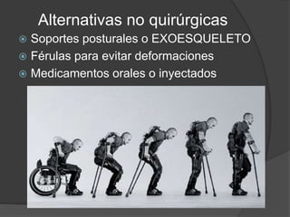 Alternativas no quirúrgicas
 Soportes posturales o EXOESQUELETO
 Férulas para evitar deformaciones
 Medicamentos orales o inyectados
 