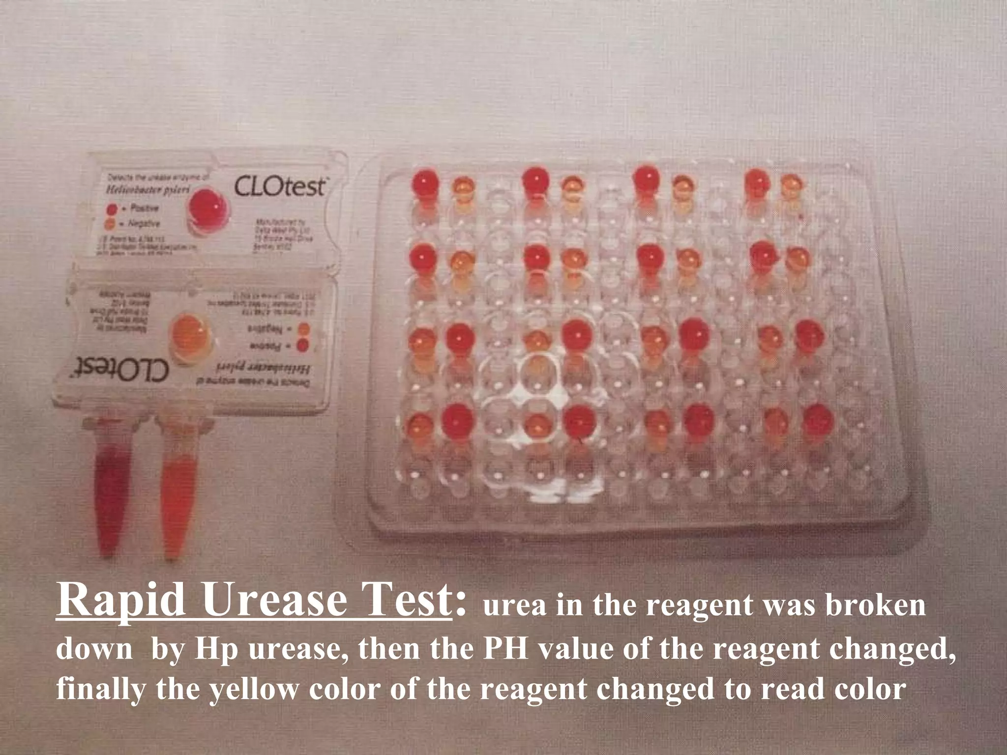 Rapid Urease Test :  urea in the reagent was broken down  by Hp urease, then the PH value of the reagent changed, finally the yellow color of the reagent changed to read color 