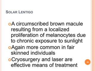 SOLAR LENTIGO
A circumscribed brown macule
resulting from a localized
proliferation of melanocytes due
to chronic exposure to sunlight
Again more common in fair
skinned individuals
Cryosurgery and laser are
effective means of treatment
30
 