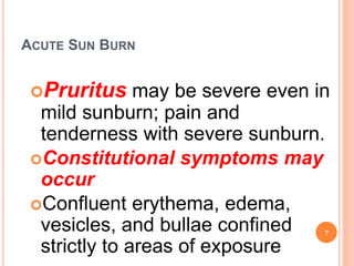 ACUTE SUN BURN
Pruritus may be severe even in
mild sunburn; pain and
tenderness with severe sunburn.
Constitutional symptoms may
occur
Confluent erythema, edema,
vesicles, and bullae confined
strictly to areas of exposure
7
 