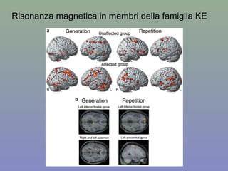 Risonanza magnetica in membri della famiglia KE
 