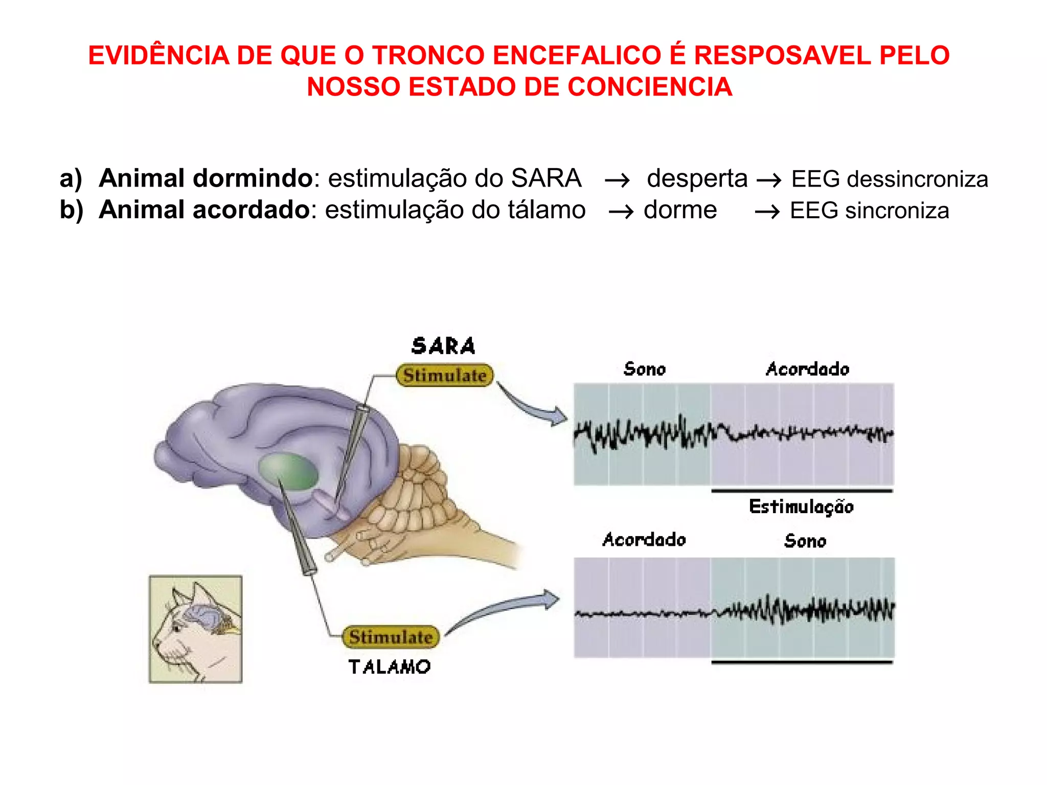 a) Animal dormindo: estimulação do SARA → desperta → EEG dessincroniza
b) Animal acordado: estimulação do tálamo → dorme → EEG sincroniza
EVIDÊNCIA DE QUE O TRONCO ENCEFALICO É RESPOSAVEL PELO
NOSSO ESTADO DE CONCIENCIA
 