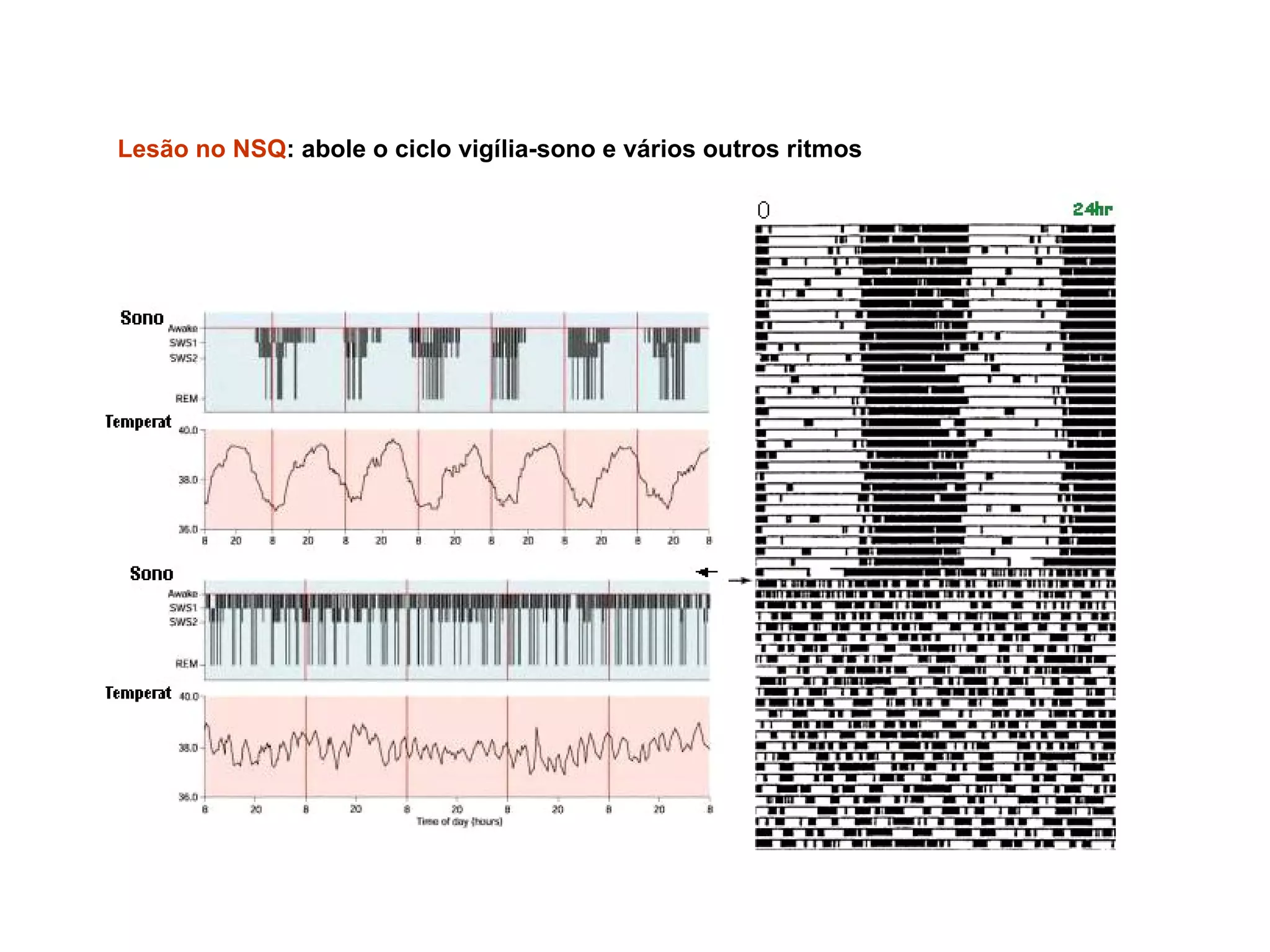 Lesão no NSQ: abole o ciclo vigília-sono e vários outros ritmos
 