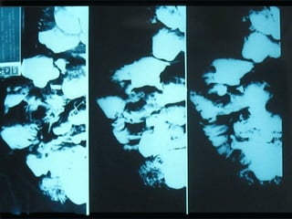 18 transito intestinal