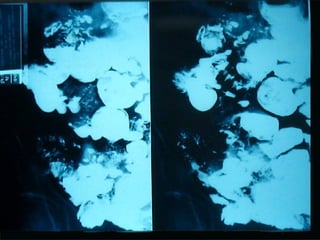 18 transito intestinal