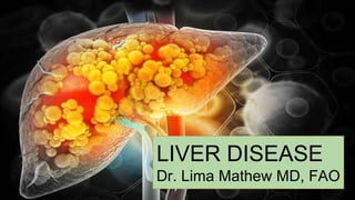 LIVER DISEASE
Dr. Lima Mathew MD, FAO
 