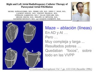 Los comienzos …
Maze – ablación (líneas)
En AD y AI …
Pero …
Muy compleja y larga ...
Resultados pobres …
Quedaban “focos”, sobre
todo en las VVPP

 