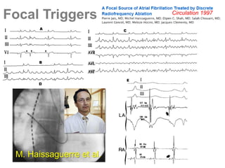 Focal Triggers

M. Haissaguerre et al.

Circulation 1997

 