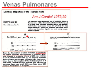 Venas Pulmonares
Am J Cardiol 1972;29

 