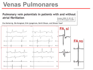 Venas Pulmonares

FA sí
FA no

 