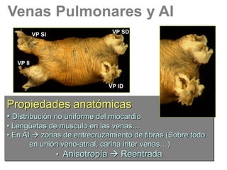 Venas Pulmonares y AI
VP SI

VP SD

VP II

VP ID

Propiedades anatómicas
• Distribución no uniforme del miocardio
• Lengüetas de musculo en las venas…
• En AI  zonas de entrecruzamiento de fibras (Sobre todo
en unión veno-atrial, carina inter venas…)
• Anisotropía  Reentrada

 