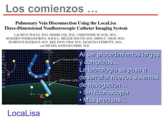 Los comienzos …

Al ser procedimientos largos
y complejos…
La tecnología se puso a
desarrollar nuevos sistemas
de navegación…
• Sin fluoroscopia
• Más precisos…

LocaLisa

 