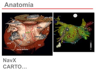 Anatomía

NavX
CARTO…

 