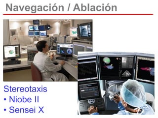 Navegación / Ablación

Stereotaxis
• Niobe II
• Sensei X

 