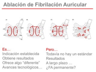 Ablación de Fibrilación Auricular

Es…
Indicación establecida
Obtiene resultados
Ofrece algo “diferente”
Avances tecnológicos…

Pero…
Todavía no hay un estándar
Resultados
A largo plazo …
¿FA permanente?

 