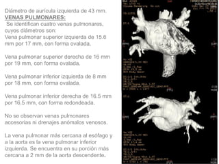 Diámetro de aurícula izquierda de 43 mm.
VENAS PULMONARES:
Se identifican cuatro venas pulmonares,
cuyos diámetros son:
Vena pulmonar superior izquierda de 15.6
mm por 17 mm, con forma ovalada.
Vena pulmonar superior derecha de 16 mm
por 19 mm, con forma ovalada.

Vena pulmonar inferior izquierda de 8 mm
por 18 mm, con forma ovalada.
Vena pulmonar inferior derecha de 16.5 mm
por 16.5 mm, con forma redondeada.
No se observan venas pulmonares
accesorias ni drenajes anómalos venosos.
La vena pulmonar más cercana al esófago y
a la aorta es la vena pulmonar inferior
izquierda. Se encuentra en su porción más
cercana a 2 mm de la aorta descendente.

FR

 