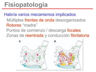 Fisiopatología
Habría varios mecanismos implicados
• Múltiples frentes de onda desorganizados
Rotores “madre”
Puntos de comienzo / descarga focales
Zonas de reentrada y conducción fibrilatoria

 