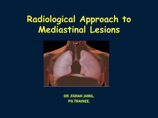 Radiological Approach to
Mediastinal Lesions
DR .FARAH JAMIL.
PG TRAINEE.
 