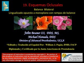  	
  19.	
  Esquemas	
  Oclusales	
  
	
  	
  Balance	
  	
  Bilateral	
  

Lingualizado	
  opuesto	
  a	
  monoplano	
  con	
  rampas	
  de	
  balance	
  

John Beumer III, DDS, MS,
Michael Hamada, DDS
Division of Advanced Prosthodontics, UCLA
*Editado y Traducido al Español Por: William J. Pagán, DMD, FACP
Diplomado y Certificado por la Junta Americana de Prostodoncia
This program of instruction is protected by copyright ©. No portion of
this program of instruction may be reproduced, recorded or transferred
by any means electronic, digital, photographic, mechanical etc., or by
any information storage or retrieval system, without prior permission.

 