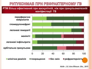 0 20 40 60 80 100
орбітальна гранульома
легеневі інфільтрати
менінгіт
легеневі геморагії
гломерулонефрит
периферична
нейропатія
клінічна ремісія покращання без змін рефрактерність
РТМ більш ефективний при васкулітній, ніж при гранульоматозній
маніфестації ГВ
Holle J.U. Ann.Rheum. Dis., 2011
 