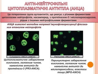 АНЦА виявлені методом непрямої імунофлюоресценції фіксова-
них етанолом нейтрофілів
Цитоплазматичне забарвлення
викликане, головним чином,
наявністю антитіл до
протеїнази-3 (PR3-ANCA).
Перинуклеарне забарвлення
викликане, головним чином,
наявністю антитіл до
мієлопероксидази, еластази
тощо (MPO-ANCA)
Це гетерогенна група аутоантитіл, що реагує з різними ферментами
цитоплазми нейтрофілів, насамперед, з протеїназою-3 і мієлопероксидазою,
рідше з іншими нейтрофільними ферментами
 