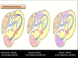 Hipoxemia afecta
a la sangre arterial.
Hipoxia afecta
a los tejidos periféricos
Anoxia afecta
a los órganos y cerebro.
Definiciones básicas
 
