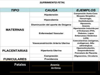 Fetales Anemia
Arritmia
 