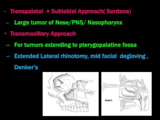 Sublabial Excision Angiofibroma | PPTX