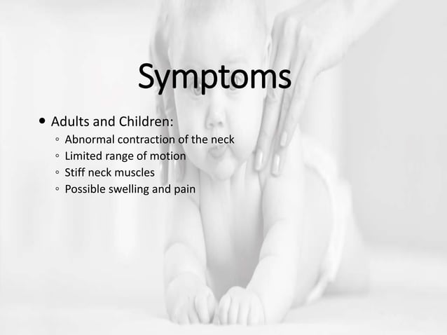 Picture of 19. torticollis | PPTX