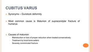 CUBITUS VARUS
 Synonyms – Gunstock deformity
 Most common cause is Malunion of supracondylar
humerus
fracture of
 Causes of malunion
Malreduction or loss of proper reduction when treated conservatively
Treatment by local bone setters
Severely comminuted fracture
 