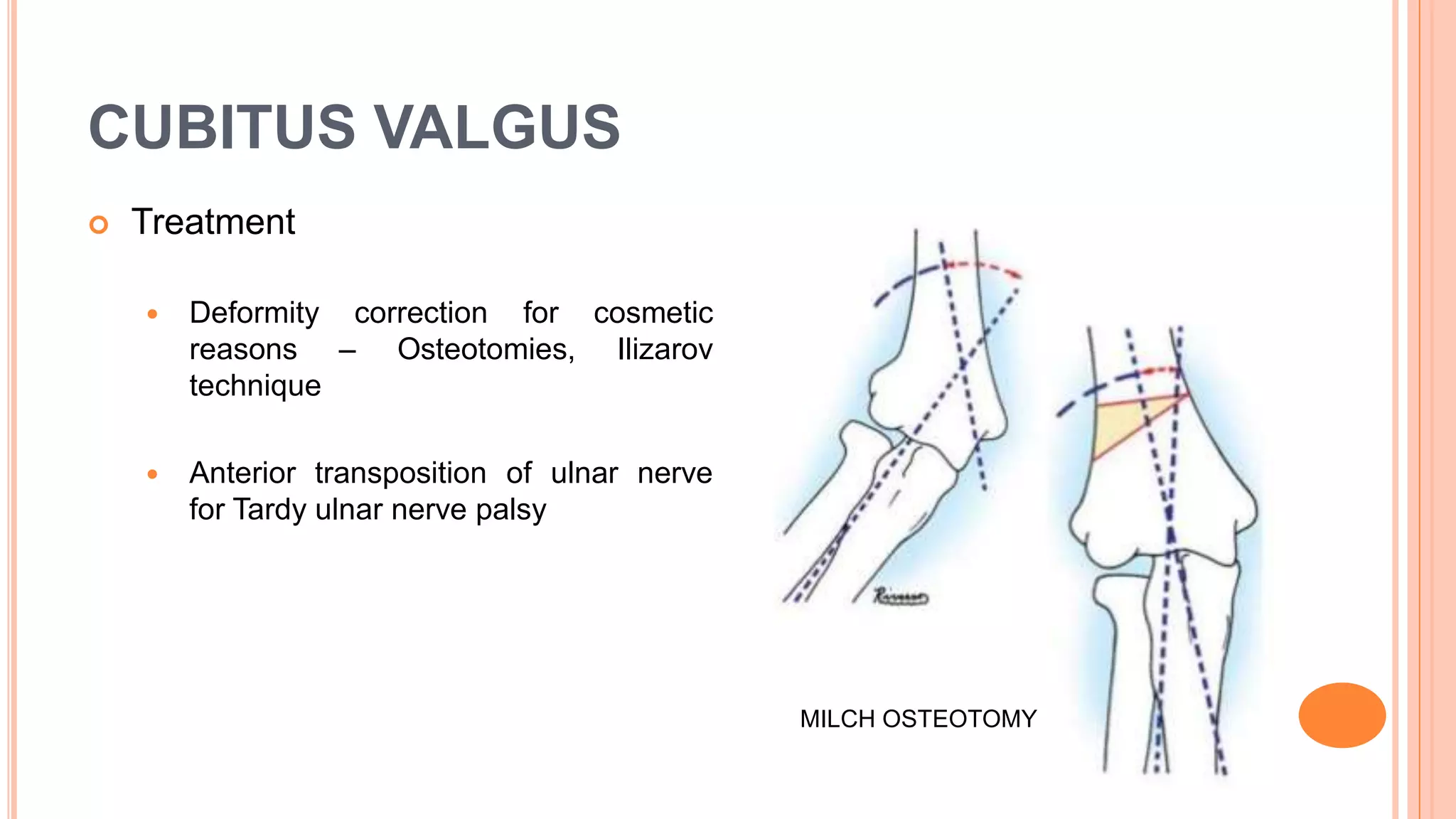 Ulna Varus Cubitus varus and valgus | PPTX
