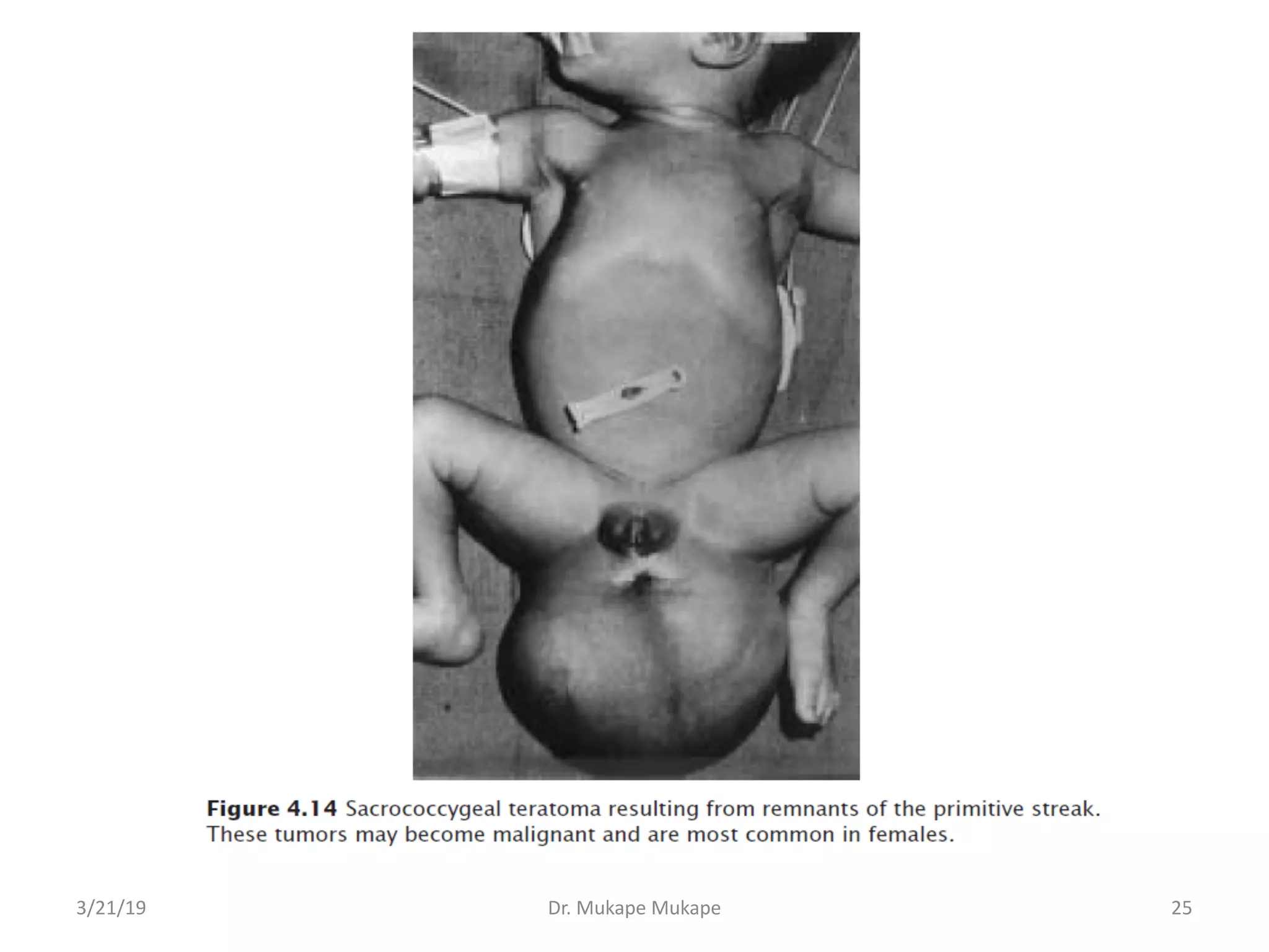 3/21/19 Dr. Mukape Mukape 25
 