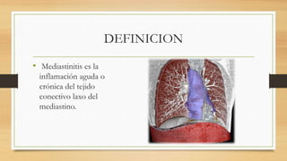 DEFINICION
• Mediastinitis es la
inflamación aguda o
crónica del tejido
conectivo laxo del
mediastino.
 