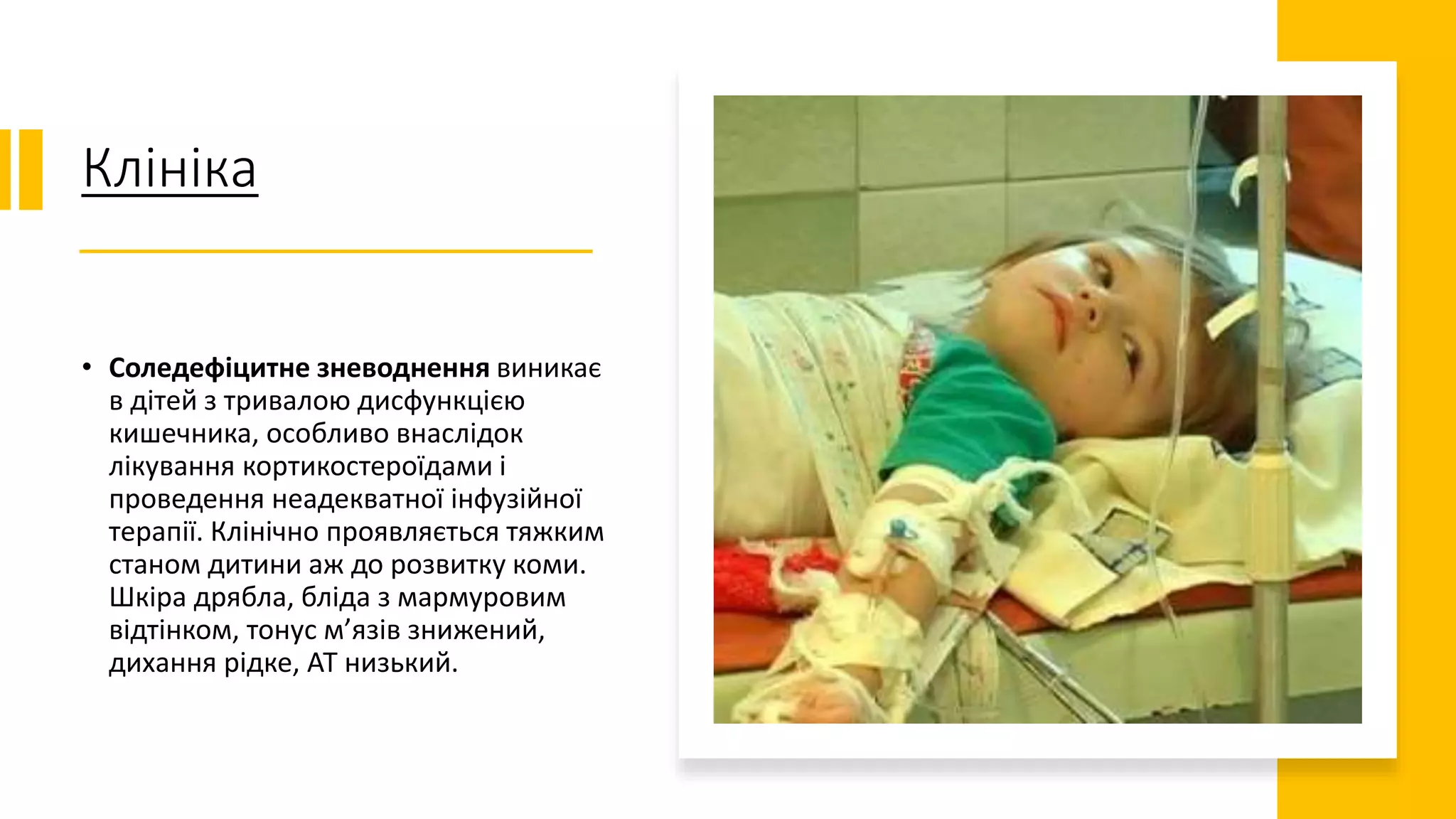 Клініка
• Соледефіцитне зневоднення виникає
в дітей з тривалою дисфункцією
кишечника, особливо внаслідок
лікування кортикостероїдами і
проведення неадекватної інфузійної
терапії. Клінічно проявляється тяжким
станом дитини аж до розвитку коми.
Шкіра дрябла, бліда з мармуровим
відтінком, тонус м’язів знижений,
дихання рідке, АТ низький.
 