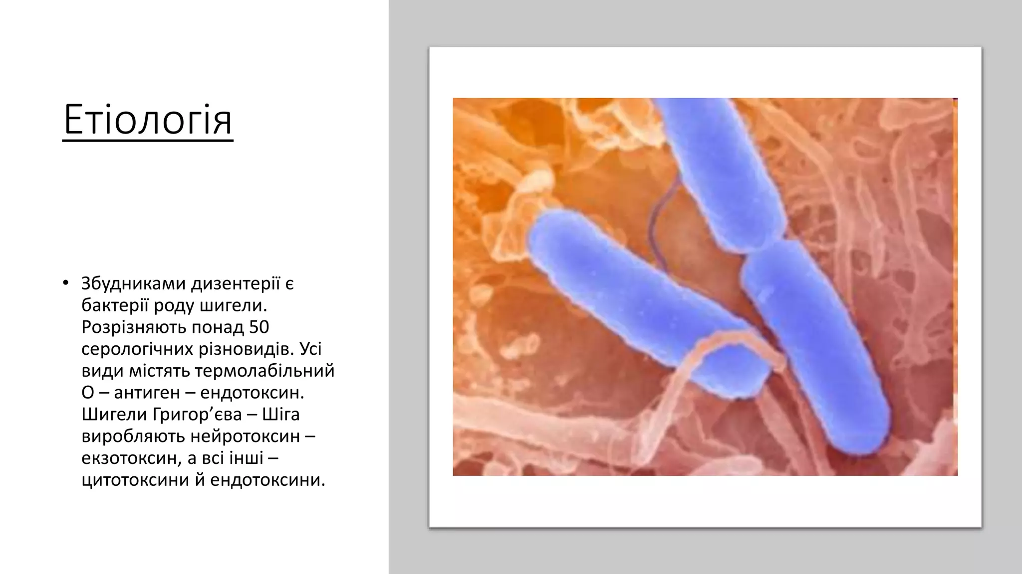 Етіологія
• Збудниками дизентерії є
бактерії роду шигели.
Розрізняють понад 50
серологічних різновидів. Усі
види містять термолабільний
О – антиген – ендотоксин.
Шигели Григор’єва – Шіга
виробляють нейротоксин –
екзотоксин, а всі інші –
цитотоксини й ендотоксини.
 