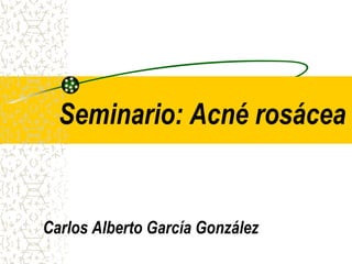 Seminario: Acné rosácea
Carlos Alberto García González
 